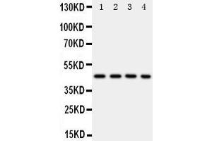 Anti-PDK2 antibody, Western blotting Lane 1: Rat Heart Tissue Lysate Lane 2: HELA Cell Lysate Lane 3: SW620 Cell Lysate Lane 4: MCF-7 Cell Lysate