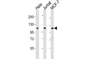 All lanes : Anti-EXOC4 Antibody (N-term) at 1:2000 dilution Lane 1: Hela whole cell lysates Lane 2: Jurkat whole cell lysates Lane 3: MCF-7 whole cell lysates Lysates/proteins at 20 μg per lane. (Sec8 antibody  (N-Term))
