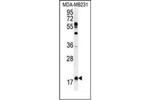 Western blot analysis of RHEB Antibody (C-term) in MDA-MB231 cell line lysates (35ug/lane). (RHEB antibody  (C-Term))