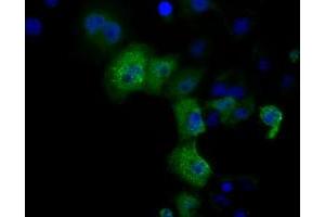 Anti-DCXR mouse monoclonal antibody (ABIN2452945) immunofluorescent staining of COS7 cells transiently transfected by pCMV6-ENTRY DCXR (RC200023). (DCXR antibody)