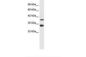 Image no. 2 for anti-T-Cell Acute Lymphocytic Leukemia 1 (TAL1) (AA 236-285) antibody (ABIN6735910) (TAL1 antibody  (AA 236-285))