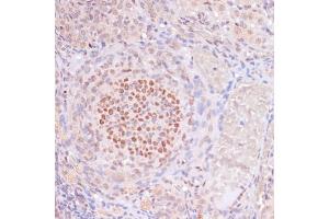 Immunohistochemistry of paraffin-embedded rat ovary using Acetyl-Histone H3-K23 antibody (ABIN7267669) at dilution of 1:100 (40x lens). (Histone 3 antibody  (H3K23))