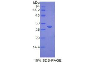 SDS-PAGE (SDS) image for Fibulin 4 (FBLN4) (AA 182-431) protein (His tag) (ABIN2121069)