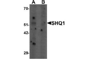Western blot analysis of SHQ1 in human heart tissue lysate with SHQ1 Antibody  at 1 ug/mL in (A) the absence and (B) the presence of blocking peptide. (SHQ1 antibody  (N-Term))