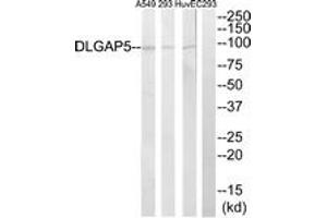 Western blot analysis of extracts from A549/293/HuvEc cells, using DLGAP5 Antibody. (DLGAP5 antibody  (AA 791-840))