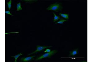 Immunofluorescence of monoclonal antibody to TLN1 on HeLa cell. (TLN1 antibody  (AA 1324-1424))