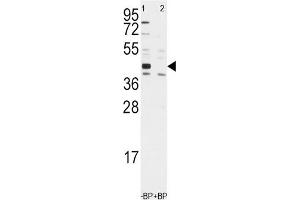 Western Blotting (WB) image for anti-Aldehyde Dehydrogenase 1 Family, Member A3 (ALDH1A3) antibody (ABIN3003524)