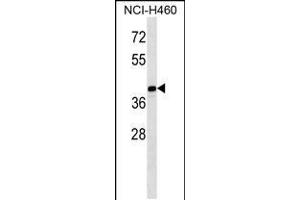 Western blot analysis in NCI-H460 cell line lysates (35ug/lane). (MAGEB10 antibody  (AA 88-116))