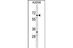 Western blot analysis in A2058 cell line lysates (35ug/lane). (ARID5A antibody  (AA 382-411))