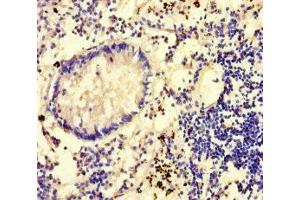 Immunohistochemistry of paraffin-embedded human appendix tissue using ABIN7149462 at dilution of 1:100 (GLCE antibody  (AA 29-617))