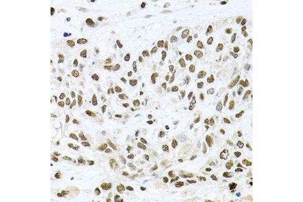 BCCIP antibody  (AA 1-314)