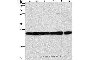 Western blot analysis of Mouse liver and brain tissue, 293T, A549, A431 and PC3 cell, using SIGMAR1 Polyclonal Antibody at dilution of 1:310 (SIGMAR1 antibody)