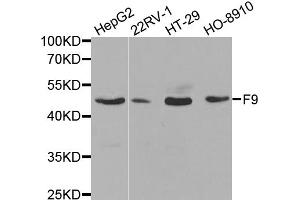 Western blot analysis of extracts of various cell lines, using F9 antibody (ABIN5970759) at 1/1000 dilution. (Coagulation Factor IX antibody)