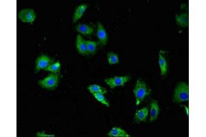 Immunofluorescent analysis of HepG2 cells using ABIN7142627 at dilution of 1:100 and Alexa Fluor 488-congugated AffiniPure Goat Anti-Rabbit IgG(H+L) (Serotonin Receptor 3A antibody  (AA 322-455))