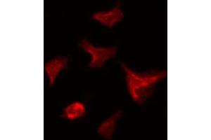 ABIN6266669 staining HeLa by IF/ICC. (UBA7 antibody  (C-Term))