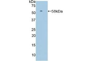 Detection of Recombinant SELL, Human using Polyclonal Antibody to Selectin, Leukocyte (SELL)