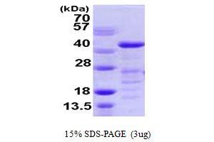 SDS-PAGE (SDS) image for Vasodilator-Stimulated phosphoprotein (VASP) (AA 1-343) protein (His tag) (ABIN667900)