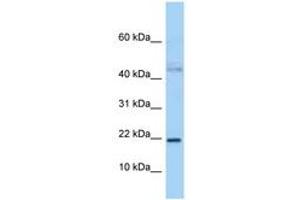 Image no. 1 for anti-Jun Dimerization Protein 2 (JDP2) (N-Term) antibody (ABIN6747974) (JDP2 antibody  (N-Term))