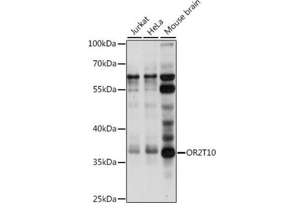 OR2T10 antibody  (AA 1-100)