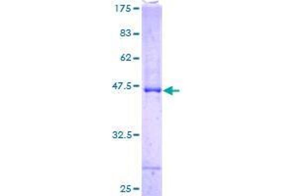 ASB6 Protein (AA 1-197) (GST tag)