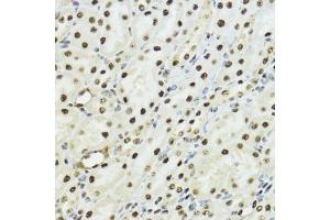Immunohistochemistry of paraffin-embedded mouse kidney using Phospho-Histone H3-S10/T11 antibody (ABIN7267688) at dilution of 1:100 (40x lens). (Histone 3 antibody  (H3S10p, H3T11p))