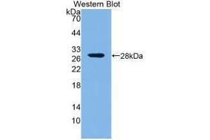 Western blot analysis of the recombinant protein. (ROR1 antibody  (AA 470-707))