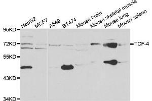 Western blot analysis of extracts of various cell lines, using TCF4 antibody. (TCF4 antibody)