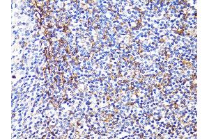 Immunohistochemistry of paraffin-embedded human tonsil using S100A10 antibody (ABIN5971035) at dilution of 1/100 (40x lens). (S100A10 antibody)