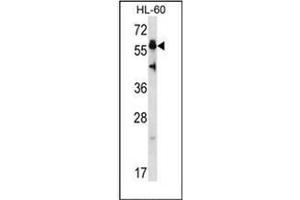 Western blot analysis of Heat shock factor 4 / HSF4 (N-term) Antibody (N-term) in HL-60 cell line lysates (35ug/lane). (HSF4 antibody  (N-Term))