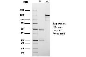 SDS-PAGE Analysis Purified Chromogranin A Mouse Recombinant Monoclonal Ab (rCHGA/798). (Recombinant Chromogranin A antibody)