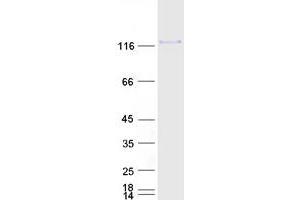Western Blotting (WB) image for CD34 (CD34) (Transcript Variant 1) protein (Myc-DYKDDDDK Tag) (ABIN2713681)
