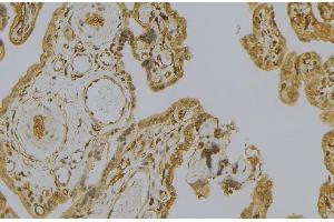 ABIN6279235 at 1/100 staining Mouse placenta tissue by IHC-P. (Calpain 6 antibody  (Internal Region))