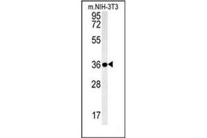 Western blot analysis of LGALS9B Antibody (Center) in mouse NIH-3T3 cell line lysates (35ug/lane).