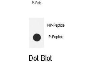 Dot blot analysis of anti-Phospho-eNos-S1177 Phospho-specific Pab on nitrocellulose membrane. (ENOS antibody  (pSer1177))