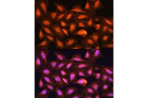 Immunofluorescence (IF) image for anti-Mdm2, p53 E3 Ubiquitin Protein Ligase Homolog (Mouse) (MDM2) (AA 200-430) antibody (ABIN6143671)