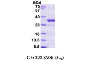 SDS-PAGE (SDS) image for Fibroblast Growth Factor 14 (FGF14) (AA 1-247) protein (His tag) (ABIN5853003) (FGF14 Protein (AA 1-247) (His tag))