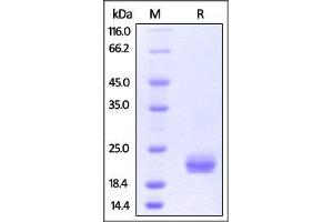 Human ROR1 (165-305, Frizzled domain), His Tag on SDS-PAGE under reducing (R) condition.