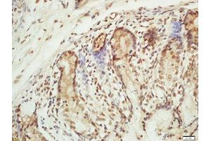 Formalin-fixed and paraffin embedded mouse intestine labeled with Rabbit Anti-RPA2(Thr21) Polyclonal Antibody, Unconjugated (ABIN713351) at 1:200 followed by conjugation to the secondary antibody and DAB staining (RPA2 antibody  (pThr21))