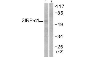 Western Blotting (WB) image for anti-Signal-Regulatory Protein alpha (SIRPA) (C-Term) antibody (ABIN1848773) (SIRPA antibody  (C-Term))