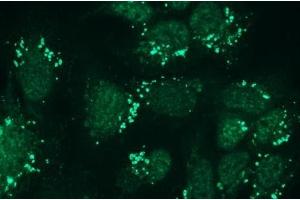 Immunocytochemistry (ICC) image for anti-Nephrosis 1, Congenital, Finnish Type (Nephrin) (NPHS1) antibody (ABIN870330) (Nephrin antibody)