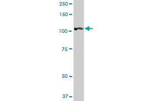 LONP1 MaxPab rabbit polyclonal antibody. (LONP1 antibody  (AA 1-959))