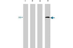 Western blot analysis of extract from red sea bream (lane 1) , carp (lane 2) , mummichog (lane 3) and medaka (lane 4) , using Vitellogenin monoclonal antibody, clone 3C1  . (Vitellogenin 2 antibody)
