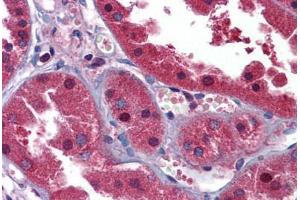 Human Kidney: Formalin-Fixed, Paraffin-Embedded (FFPE) (HINT1 antibody  (N-Term))