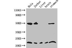 Western Blot Positive WB detected in: Hela whole cell lysate, Jurkat whole cell lysate, Mouse liver tissue, Mouse brain tissue, Mouse stomach tissue All lanes: COMMD1 antibody at 3. (COMMD1 antibody  (AA 2-190))