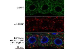 From left to right: Nicotiana tabacum protoplast total protein with Triton X100, 0. (SEC21 antibody)