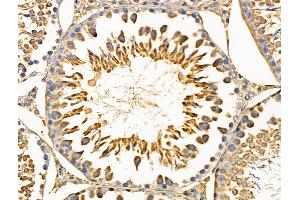 ABIN6258124 and ABIN6274665 at 1/100 staining Rat testis tissue by IHC-P.