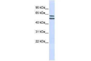 PIGQ antibody used at 1 ug/ml to detect target protein. (PIGQ antibody  (N-Term))