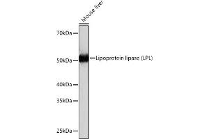Western blot analysis of extracts of Mouse liver, using Lipoprotein lipase (LPL) (LPL) Rabbit mAb (ABIN1682726, ABIN3018558, ABIN3018559 and ABIN7101626) at 1:1000 dilution. (Lipoprotein Lipase antibody)