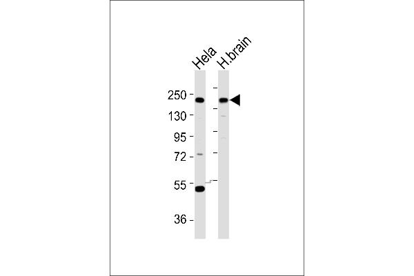 YEATS2 antibody