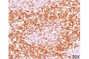 Formalin/paraffin human tonsil stained with CD6 antibody (3F7B5). (CD6 antibody)